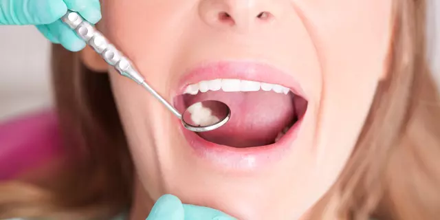 The Crucial Importance of Prevention in Gum Disease