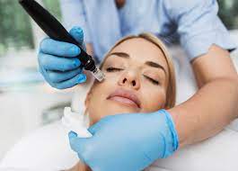 microneedling chiswick