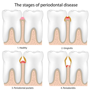 dentist chiswick